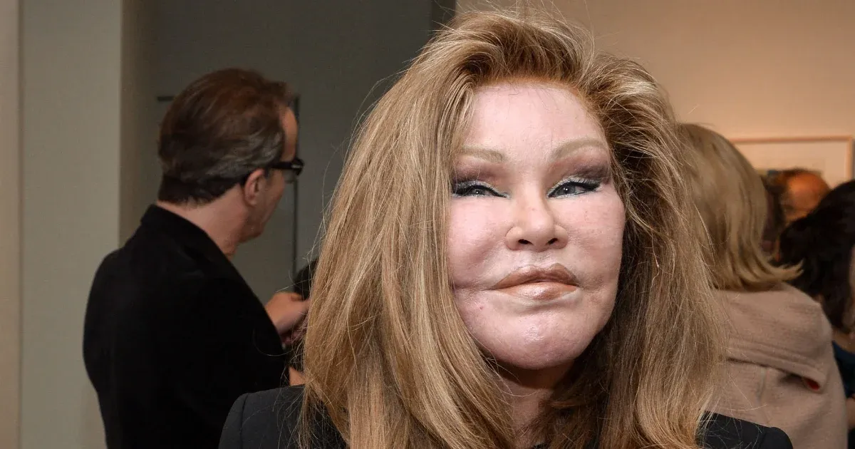 Elhunyt Jocelyne Wildenstein, a plasztikai műtétek terén végrehajtott extrém átalakulásairól híres celeb. Az ő története nemcsak a szépségipar határait feszegette, hanem számos vitát is generált a természetesség és a mesterségesség határvonaláról.